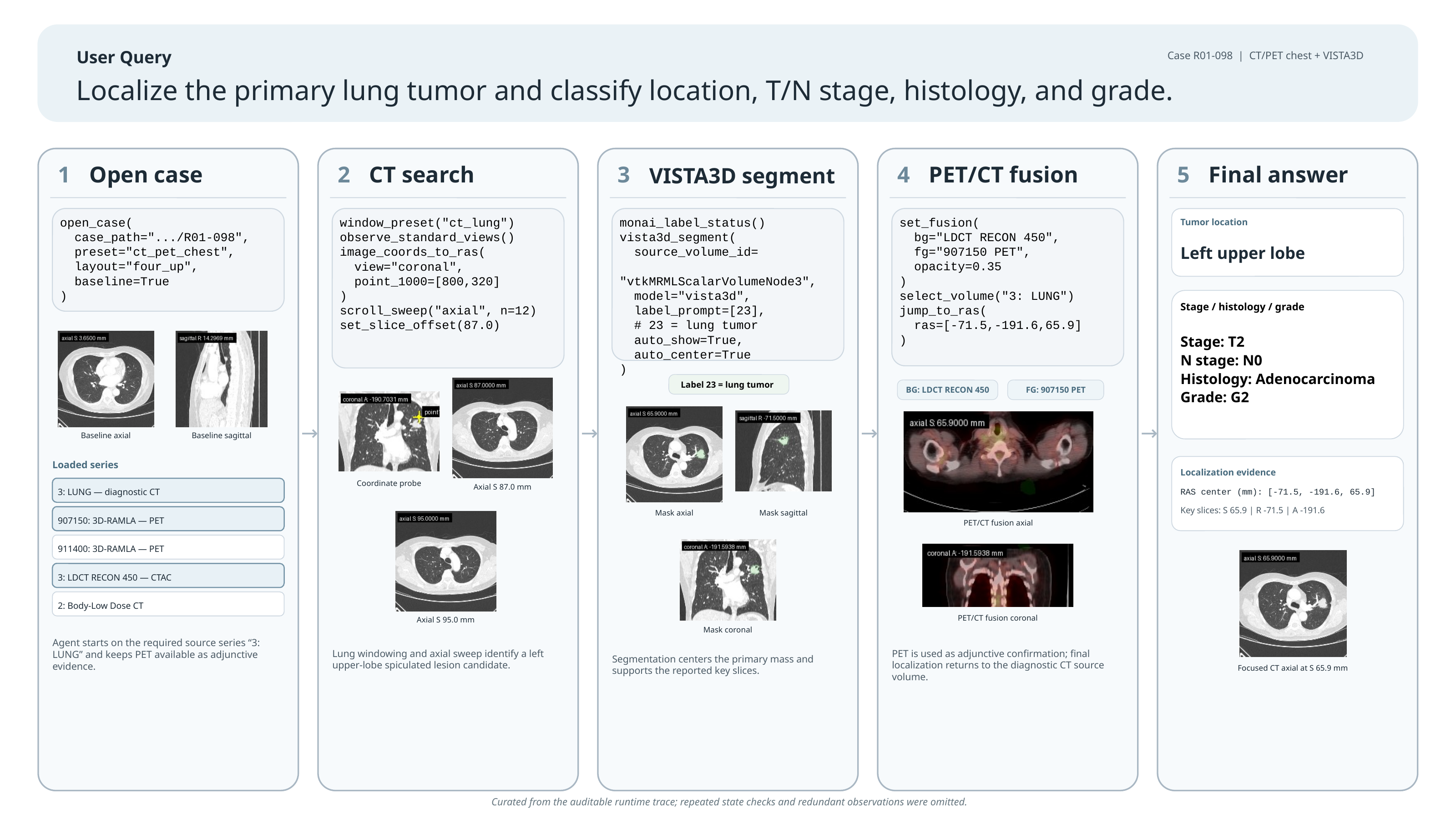 Lung PET/CT with MONAI 3D VISTA demo figure