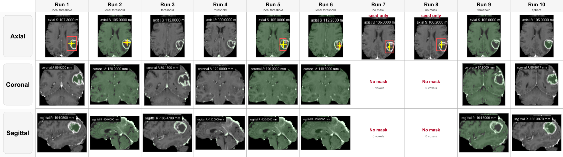 Final segmentation outputs from ten repeated runs