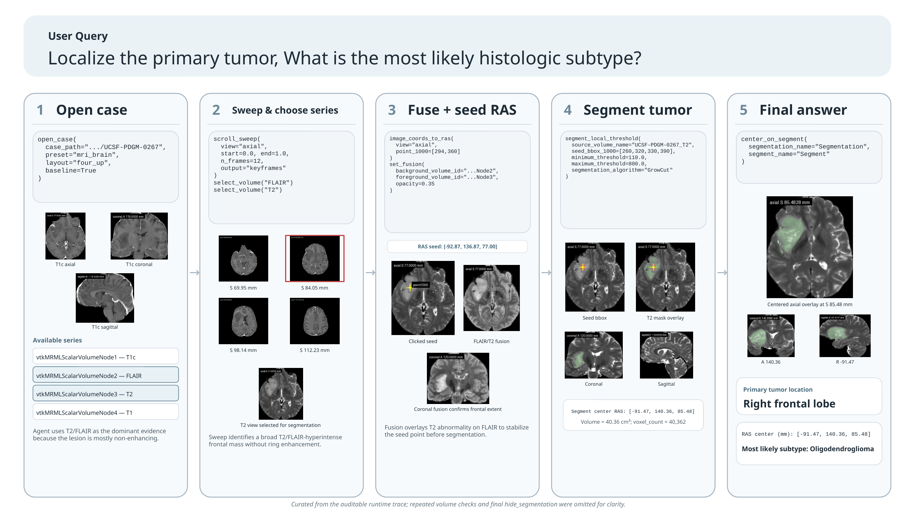 Segmentation-Assisted Brain MRI demo figure